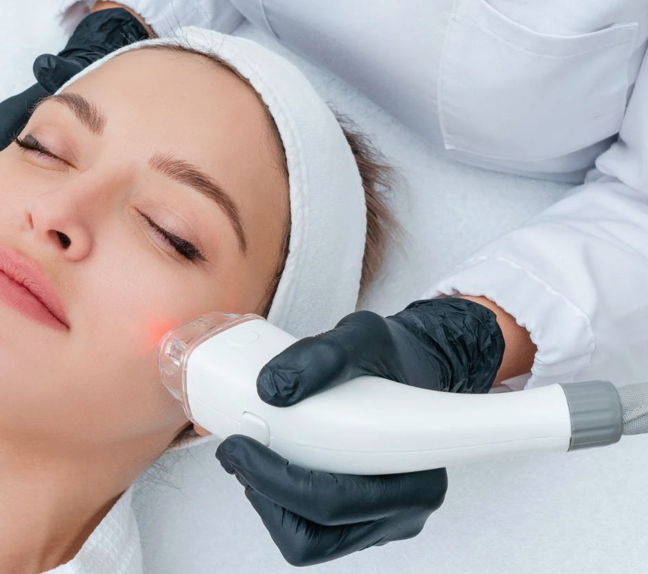 Laser Treatments