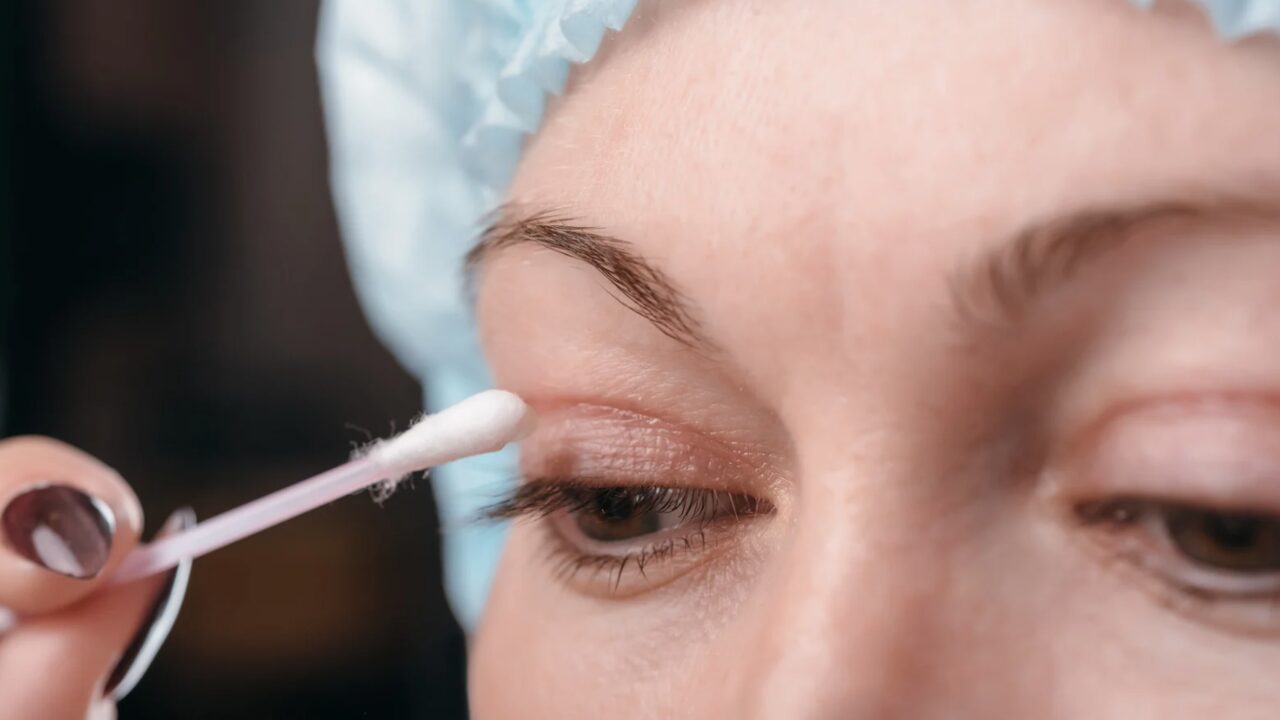 Blepharoplasty (Eyelid Surgery)