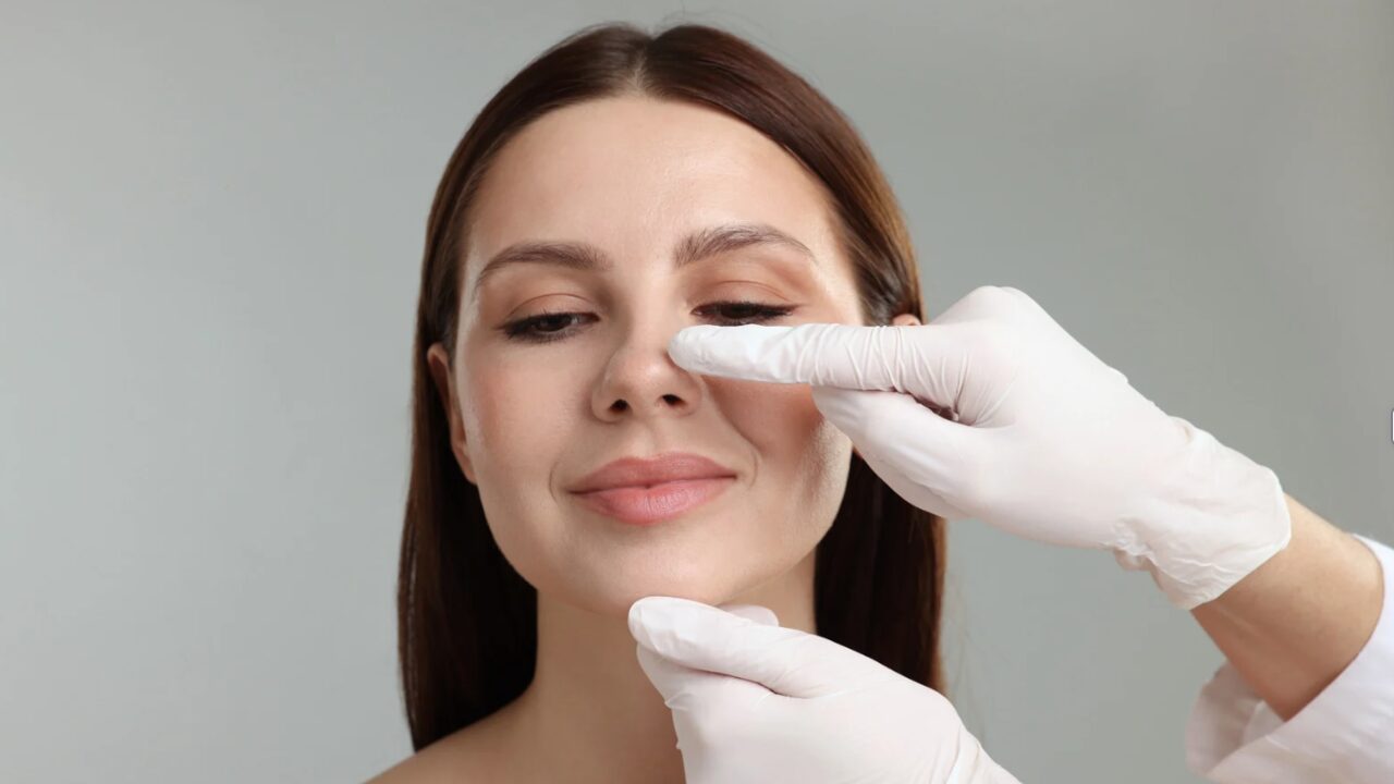 Facelift